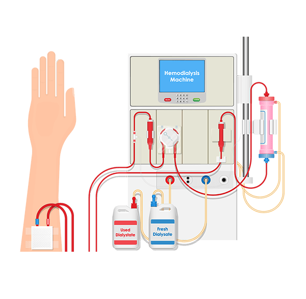  Haemodialysis